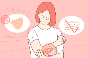 여름철에 가장 많은 환자발생! 피부 가려움증의 원인과 개선법 알아보아요 